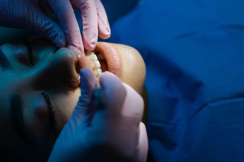 Diş Hekimi - Ortodontist